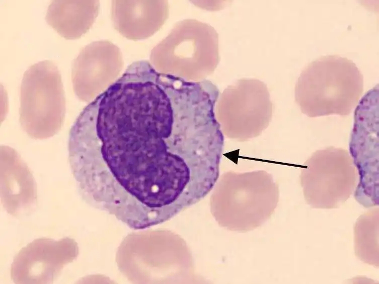 单核细胞活化反应测定试验（MAT）